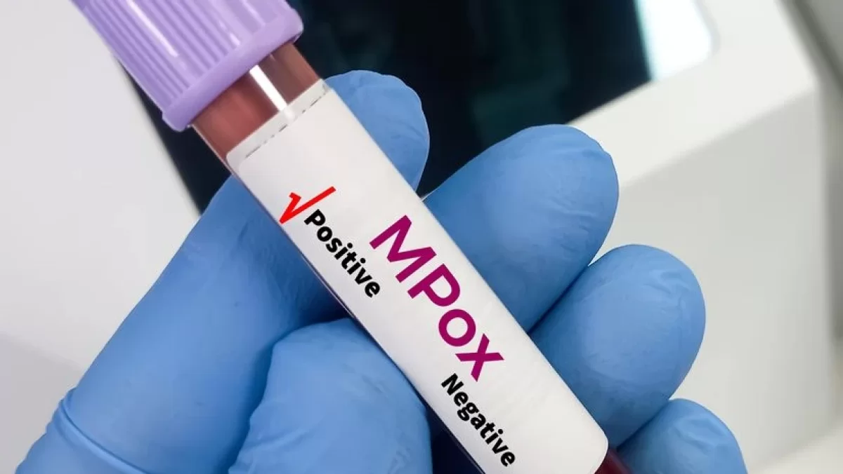 Новый вирус в Индии? Врачи говорят о mpox Clade Ib