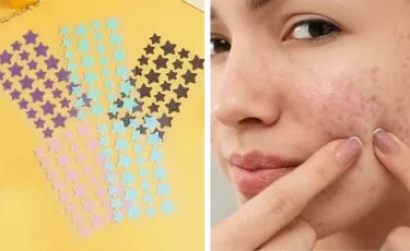Звездочки на лице и никаких прыщей: как это работает