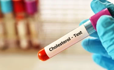 Врач объяснил, что искажает результаты анализа на холестерин