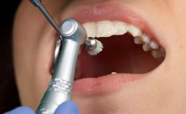 Врач объяснил, как неправильно чистит зубы большинство людей