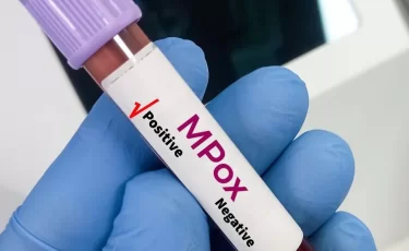 Новый вирус в Индии? Врачи говорят о mpox Clade Ib
