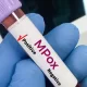 Новый вирус в Индии? Врачи говорят о mpox Clade Ib