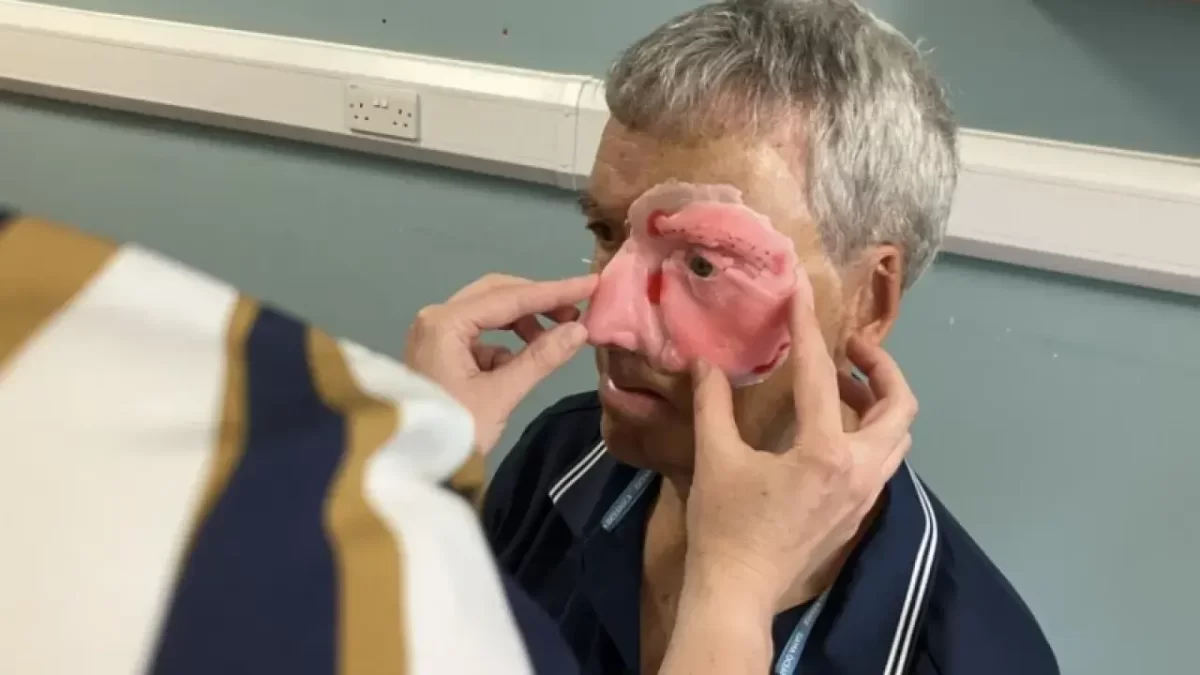 Мужчине восстановили лицо 3D-печатью