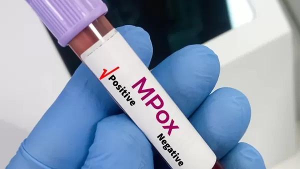 Новый вирус в Индии? Врачи говорят о mpox Clade Ib